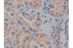 DAB staining on IHC-P; Samples: Human Kidney Tissue (CELSR3 anticorps  (AA 1181-1421))