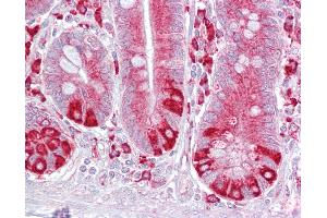 Anti-PDIA6 antibody IHC of human small intestine.