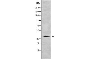 Western blot analysis of HLA-DRB1 using MCF7 whole cell lysates (HLA-DRB1 anticorps)