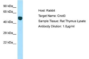 Host: Rabbit Target Name: Cnot3 Sample Type: Rat Thymus lysates Antibody Dilution: 1. (CNOT3 anticorps  (Middle Region))