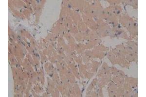 IHC-P analysis of Rat Heart Tissue, with DAB staining. (ICAM2 anticorps  (AA 29-247))