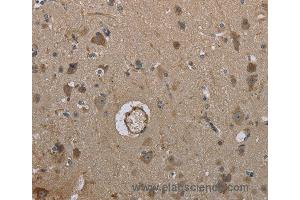 Immunohistochemistry of Human brain using MARK4 Polyclonal Antibody at dilution of 1:40 (MARK4 anticorps)