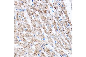 Immunohistochemistry of paraffin-embedded Rat heart using L Rabbit pAb (ABIN7268192) at dilution of 1:100 (40x lens). (LATS2 anticorps  (AA 1-100))