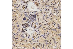 Immunohistochemistry (IHC) image for anti-Family with Sequence Similarity 160, Member B2 (FAM160B2) antibody (ABIN1872648) (FAM160B2 anticorps)
