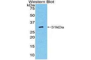 Western Blotting (WB) image for anti-Pyridoxal Kinase (PDXK) (AA 35-251) antibody (ABIN1860180) (PDXK anticorps  (AA 35-251))