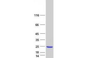 Validation with Western Blot