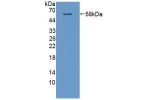 Detection of Recombinant CAMK2a, Rat using Polyclonal Antibody to Calcium/Calmodulin Dependent Protein Kinase II Alpha (CAMK2a) (CAMK2A anticorps  (AA 1-478))