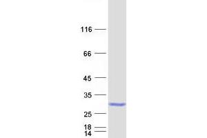Validation with Western Blot (RAB35 Protein (Myc-DYKDDDDK Tag))