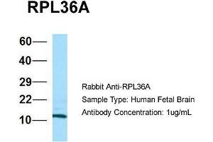 Host: Rabbit  Target Name: RPL36A  Sample Tissue: Human Fetal Brain  Antibody Dilution: 1. (RPL36AL anticorps  (C-Term))
