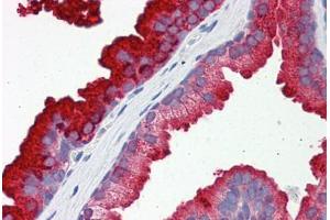 Human Prostate: Formalin-Fixed, Paraffin-Embedded (FFPE) (RAB23 anticorps  (AA 35-84))