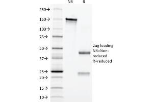 SDS-PAGE Analysis Purified Erythropoietin (EPO) Mouse Monoclonal Antibody (EPO/1367). (EPO anticorps  (AA 28-162))