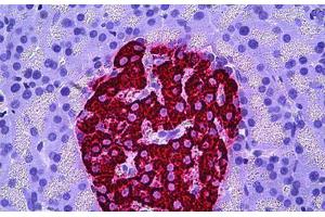 Human Pancreas, Islets of Langerhans: Formalin-Fixed, Paraffin-Embedded (FFPE)