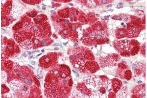 Human Adrenal: Formalin-Fixed, Paraffin-Embedded (FFPE)