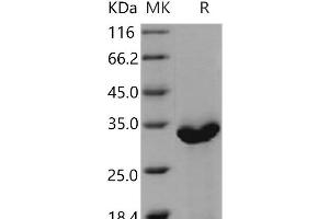 Western Blotting (WB) image for Complement Component 1, Q Subcomponent Binding Protein (C1QBP) protein (His tag) (ABIN7320370)