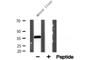 Western blot analysis of extracts from mouse liver, using AKR1CL2 antibody. (AKR1E2 anticorps  (Internal Region))