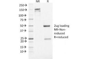 SDS-PAGE Analysis of Purified, BSA-Free Neuron Specific Enolase Antibody (clone ENO2/1462).