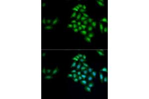Immunofluorescence analysis of MCF7 cells using KLK4 antibody (ABIN6131853, ABIN6142954, ABIN6142955 and ABIN6222339). (Kallikrein 4 anticorps  (AA 30-254))