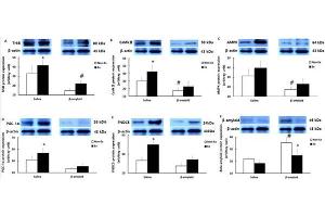 Comparisons of protein expressions of (A) TrkB, (B) CaMkII, (C) AMPK, (D) PGC-1α, (E) FNDC5, and (F) β-amyloid in the cerebral cortex after the 12-week intervention.
