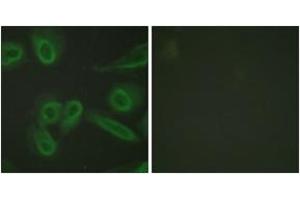 Immunofluorescence analysis of HeLa cells, using PECAM-1 (Ab-713) Antibody.