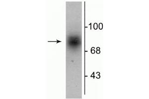 Western blot of human striatal lysate showing specific immunolabeling of the ~88 kDa DAT protein. (SLC6A3 anticorps  (C-Term, Intracellular))