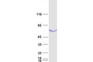 Validation with Western Blot