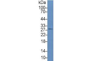 Rabbit Capture antibody from the kit in WB with Positive Control: Sample Human MCF-7 cell lysate.