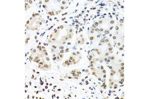 Immunohistochemistry of paraffin-embedded human stomach using IGF2BP1 antibody.