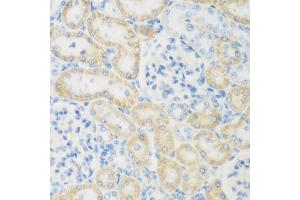 Immunohistochemistry of paraffin-embedded rat kidney using NB antibody (ABIN6132989, ABIN6144383, ABIN6144385 and ABIN6223030) at dilution of 1:200 (40x lens). (NAT8B anticorps  (AA 75-165))