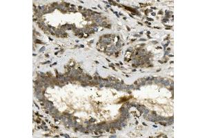IHC analysis of ETF/TEAD2 using anti-ETF/TEAD2 antibody (ABIN7599879).