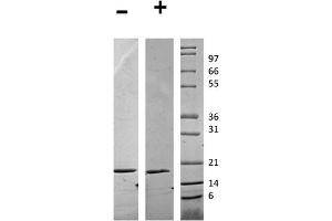 SDS-PAGE of Human Flt-3 Ligand Recombinant Protein SDS-PAGE of Human FLT-3 Ligand Recombinant Protein.