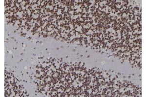 ABIN6276926 at 1/100 staining Rat brain tissue by IHC-P.