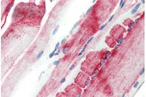 Human Skeletal Muscle (formalin-fixed, paraffin-embedded) stained with CRYAB antibody ABIN462098 at 10 µg/ml followed by biotinylated goat anti-rabbit IgG secondary antibody ABIN481713, alkaline phosphatase-streptavidin and chromogen. (CRYAB anticorps)