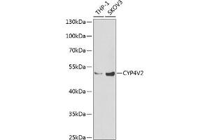 Western blot analysis of extracts of various cell lines, using CYP4V2 Antibody (ABIN6131089, ABIN6139368, ABIN6139369 and ABIN6222250) at 1:1000 dilution. (CYP4V2 anticorps  (AA 246-525))