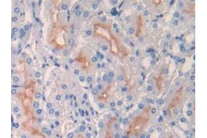 DAB staining on IHC-P; Samples: Mouse Kidney Tissue