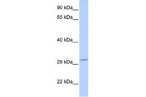 FBXO27 antibody used at 1 ug/ml to detect target protein. (FBXO27 anticorps  (Middle Region))