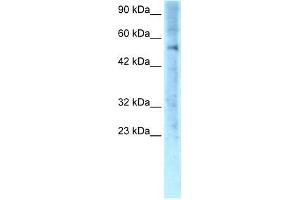 Human Jurkat; WB Suggested Anti-ZNF500 Antibody Titration: 0. (ZNF500 anticorps  (Middle Region))