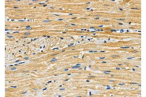 ABIN6260056 and ABIN6272251 at 1/100 staining Rat heart tissue by IHC-P. (ARRDC4 anticorps  (Internal Region))