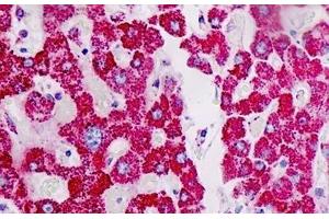 anti-Acetyl-CoA Acetyltransferase 1 (ACAT1) antibody