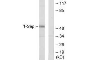 Western blot analysis of extracts from Jurkat cells, using SEPT1 Antibody. (Septin 1 anticorps  (AA 181-230))