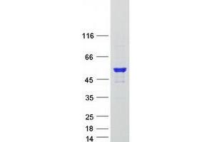 Validation with Western Blot
