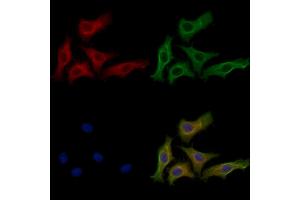 ABIN6262554 and ABIN6272583 staining HepG2 cells by IF/ICC. (IL22RA2 anticorps  (Internal Region))