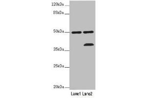 Western blot All lanes: PLIN5 antibody at 2 μg/mL Lane 1: Mouse kidney tissue Lane 2: Mouse brain tissue Secondary Goat polyclonal to rabbit IgG at 1/10000 dilution Predicted band size: 51 kDa Observed band size: 51, 36 kDa (PLIN5 anticorps  (AA 305-453))