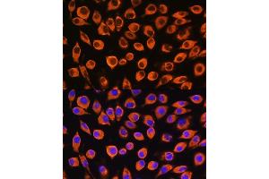 Immunofluorescence analysis of L929 cells using IL23R Rabbit pAb (ABIN3022245, ABIN3022246, ABIN3022247, ABIN1513088 and ABIN6218691) at dilution of 1:100.
