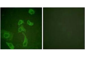 Immunofluorescence analysis of HeLa cells, using IL-2R beta (Ab-364) Antibody. (IL2 Receptor beta anticorps  (AA 331-380))