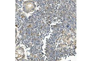 IHC analysis of Bid using anti-Bid antibody (ABIN7599062). (BID anticorps  (AA 1-195))