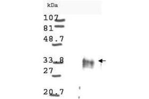 Western blot analysis is shown using  anti-Cyclin D1 antibody to detect Human Cyclin D1 present in asynchronous HN30 cell lysates. (Cyclin anticorps)