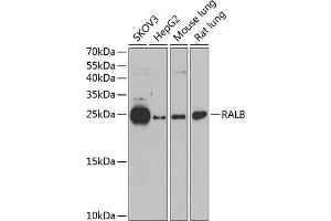 Western blot analysis of extracts of various cell lines, using RALB antibody (ABIN1682468, ABIN5664619, ABIN5664621 and ABIN6220484) at 1:1000 dilution. (RALB anticorps  (AA 1-206))