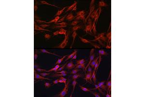 Immunofluorescence analysis of C6 cells using PIK3CG Rabbit pAb (ABIN6130600, ABIN6145638, ABIN6145639 and ABIN6222396) at dilution of 1:100 (40x lens).