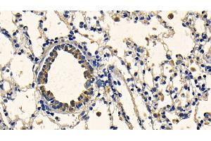 Detection of TGFb1 in Rat Lung Tissue using Polyclonal Antibody to Transforming Growth Factor Beta 1 (TGFb1)