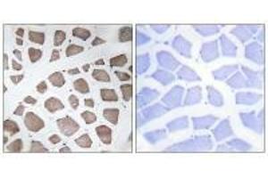 Immunohistochemistry analysis of paraffin-embedded human skeletal muscle tissue using MRPS18C antibody.